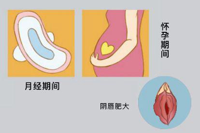 阴唇肥大的图片